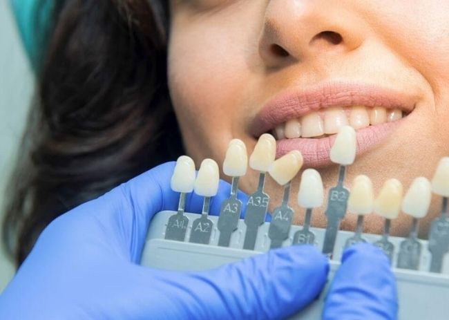 Wybielanie zębów – poznaj najczęściej powtarzane mity na ten temat!