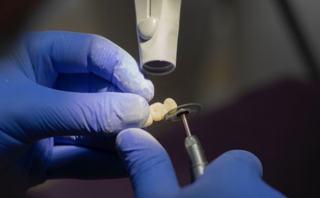 Wkład koronowo – korzeniowy – zadbaj o piękny uśmiech swoich pacjentów!