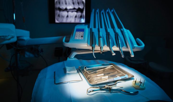 Powikłania po usunięciu ósemki – jakie mogą wystąpić?