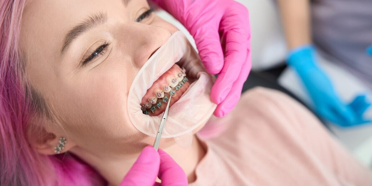Pierwsza wizyta u ortodonty – jak wygląda i jak się do niej przygotować?